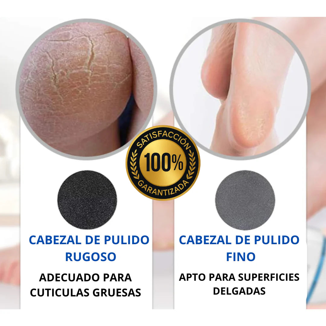 CalloClean™ – Removedor Profesional de Callos